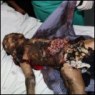 2-year-old victim of Israeli drone