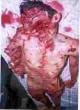 Israeli organ harvesting from Palestinians